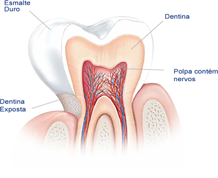 O que Causa a Sensibilidade Dentária? O que Causa a Sensibilidade Dentária?